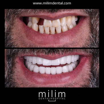 Slider image (9) Milim Dental